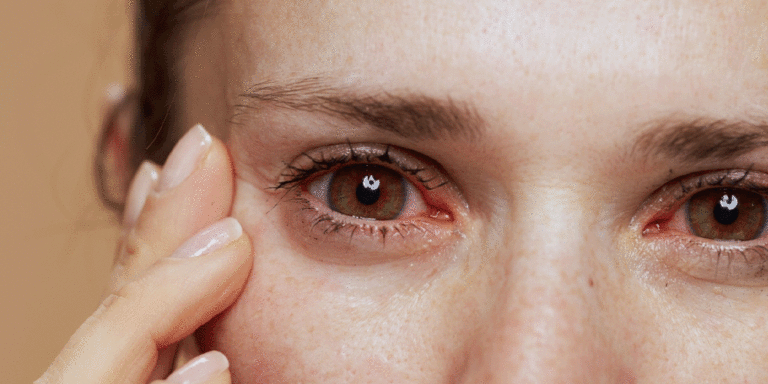 The current image has no alternative text. The file name is: eye.gif