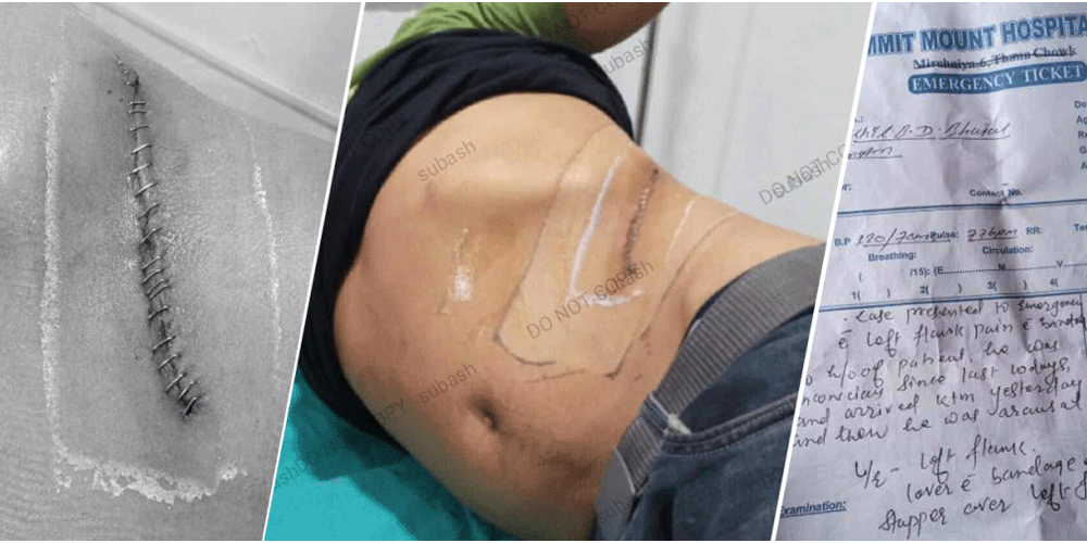 जागिरको प्रलोभनमा भारत लगेर तस्करले खिलबहादुरको मिर्गौला निकाले