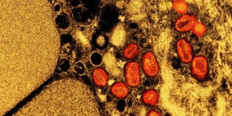 The current image has no alternative text. The file name is: mpox.gif